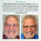 🌎 ROSOPLTM Custom-Fit Dentures ⏰ ENDS TODAY • 70% OFF | Smile with Confidence