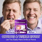 Full Set Natural Dentures Upper & Lower Silicone Fake Teeth Braces Comfort Fit Instant Confidence Smile Oral Care For Men Women